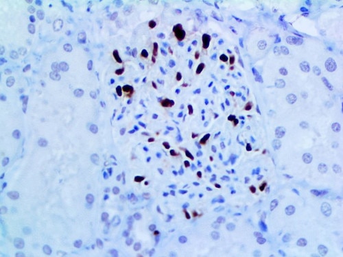IHC of p57 on an FFPE Placenta Tissue